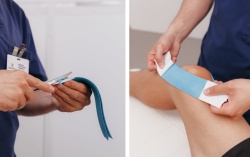 Кинезиотейпирование стопы: современный подход к восстановлению и поддержке здоровья